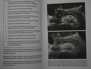 Artifacts in Diagnostic Medical Ultrasound: Grayscale Artifacts by Necas, Martin