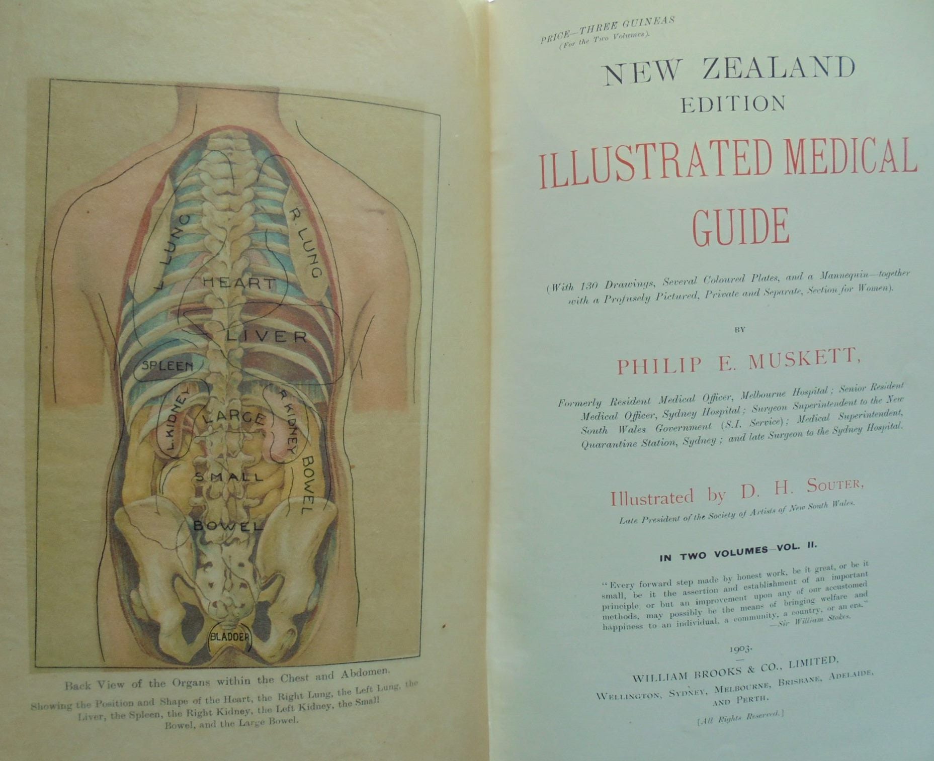 Illustrated Medical Guide New Zealand Edition : Volumes I & II By Philip E. Muskett.